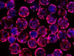 Mesenchymal Stem Cells