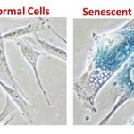 senescent-cells