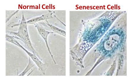 senescent-cells