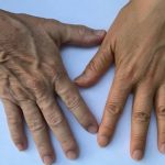 skin-aging