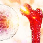 Bone,Research,Concept,Bone,Cancer,And,Stem,Cells,Treatment,Osteoporosis
