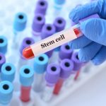 Doctor,Holding,A,Test,Blood,Sample,Tube,With,Stem,Cell